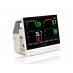 Lepu Medical AIVIEW V12 monitor vitalnih funkcija 1