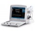Prijenosni ultrazvučni uređaj EDAN DUS 60 