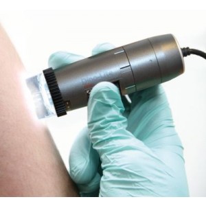 Digitalni dermatoskop DermaScope