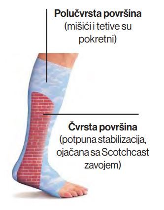 3M Soft cast™ zavoj za gips