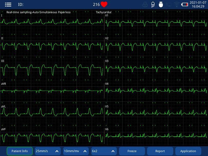 iMAC 12 EKG