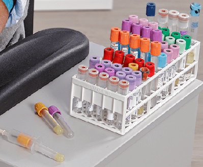 Vacutainer | Epruvete za vađenje krvi